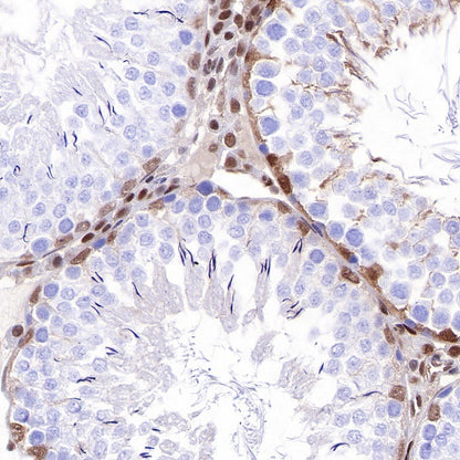 p27 Recombinant Rabbit mAb (SDT-R350)