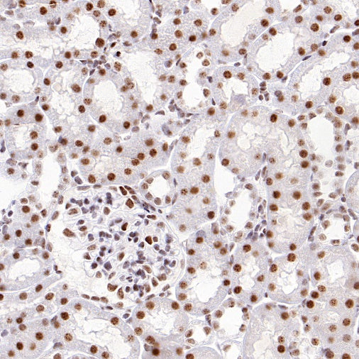TEL1 Recombinant Rabbit mAb (S-3067-60)