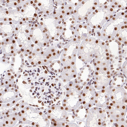 TEL1 Recombinant Rabbit mAb (S-3067-60)