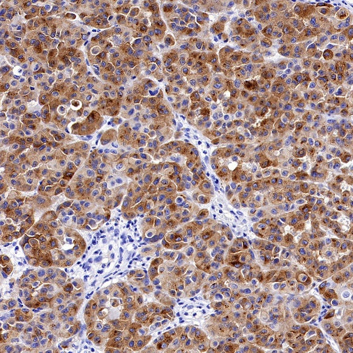 PMEL/Melanoma gp100 Recombinant Rabbit mAb (SDT-3393)