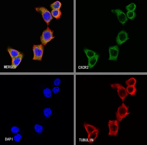 CXCR2 Recombinant Rabbit mAb (S-1292-30)