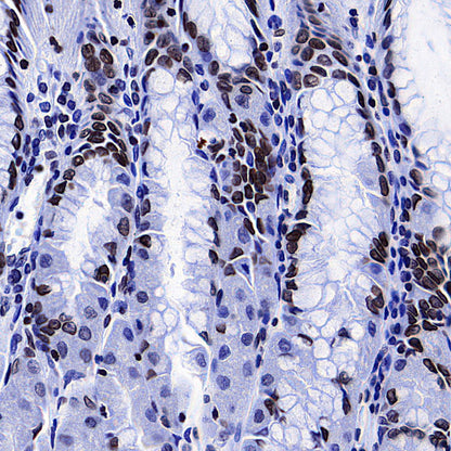 Lamin B1 Recombinant Rabbit mAb (S-5361)