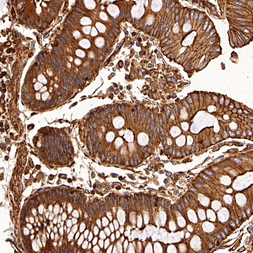 PFKL+PFKM Recombinant Rabbit mAb (S-1302-31)
