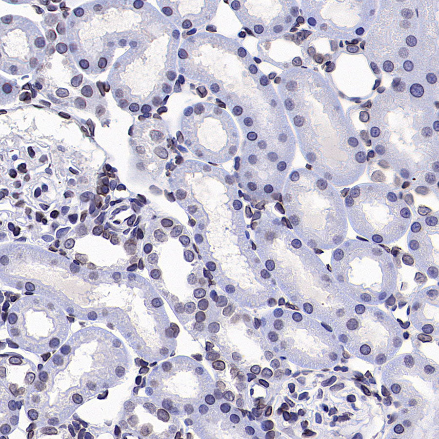Lamin B1 Recombinant Rabbit mAb (S-5361)