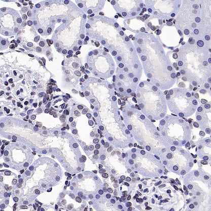 Lamin B1 Recombinant Rabbit mAb (S-5361)