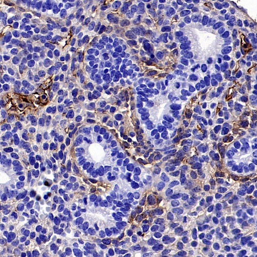 PDGFR alpha Recombinant Rabbit mAb (SDT-3353)