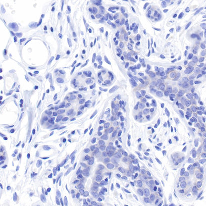 ErbB2 Recombinant Rabbit mAb (SDT-069-10)