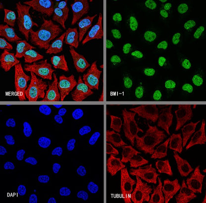 Bmi1 Recombinant Rabbit mAb (S-3313-71)