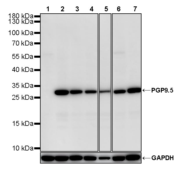 PGP9.5 Recombinant Mouse mAb (S-6071)