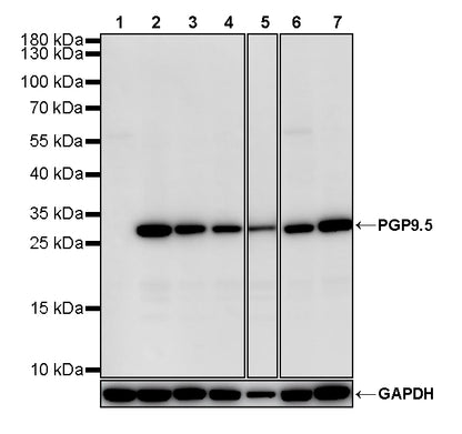 PGP9.5 Recombinant Mouse mAb (S-6071)