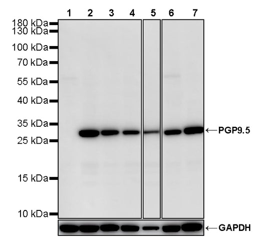 PGP9.5 Recombinant Mouse mAb (S-6071)