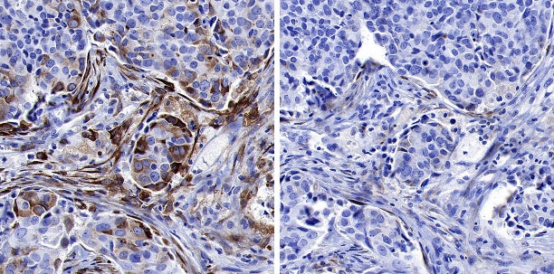 Phospho-IκBα (Ser32/36) Recombinant Rabbit mAb (S-R362)