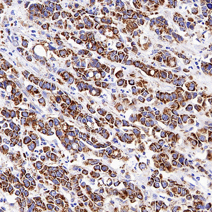 TOM20 Recombinant Rabbit mAb (S-M0015)