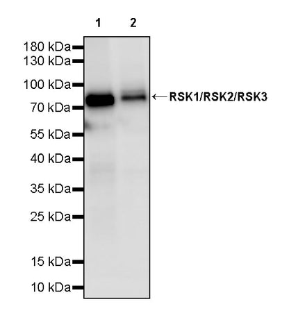 RSK1/RSK2/RSK3 Recombinant Rabbit mAb (S-4982)
