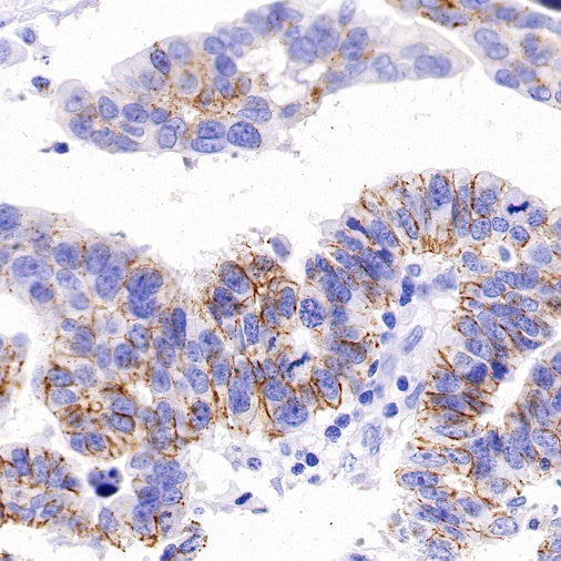 Claudin 3+Claudin 9 Recombinant Rabbit mAb (SDT-1452-69)