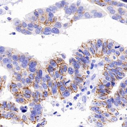 Claudin 3+Claudin 9 Recombinant Rabbit mAb (SDT-1452-69)