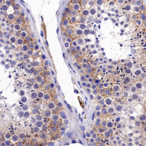 PI3 Kinase p85α Recombinant Rabbit mAb (S-328-24)