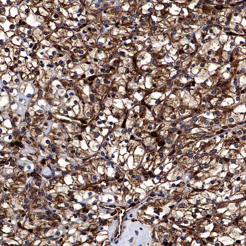 Catalase Rabbit Polyclonal Antibody
