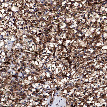 Catalase Rabbit Polyclonal Antibody