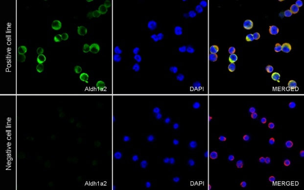 ALDH1A2 Recombinant Rabbit mAb (S-3569-78)