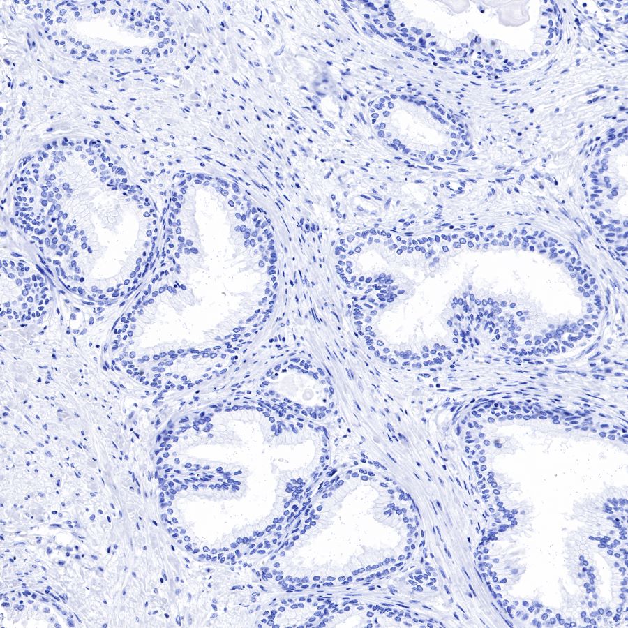alpha-actinin-2 Recombinant Rabbit mAb (SDT-032-79)
