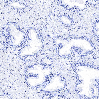 alpha-actinin-2 Recombinant Rabbit mAb (SDT-032-79)
