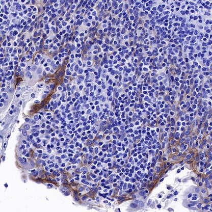 Nectin-4 Recombinant Rabbit mAb (SDT-277-326)