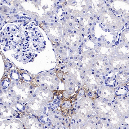 Tenascin C Recombinant Rabbit mAb (S-775-274)