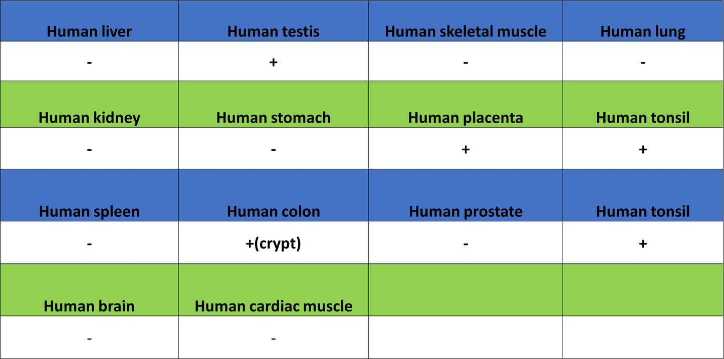 Aurora A Recombinant Rabbit mAb (S-5355)