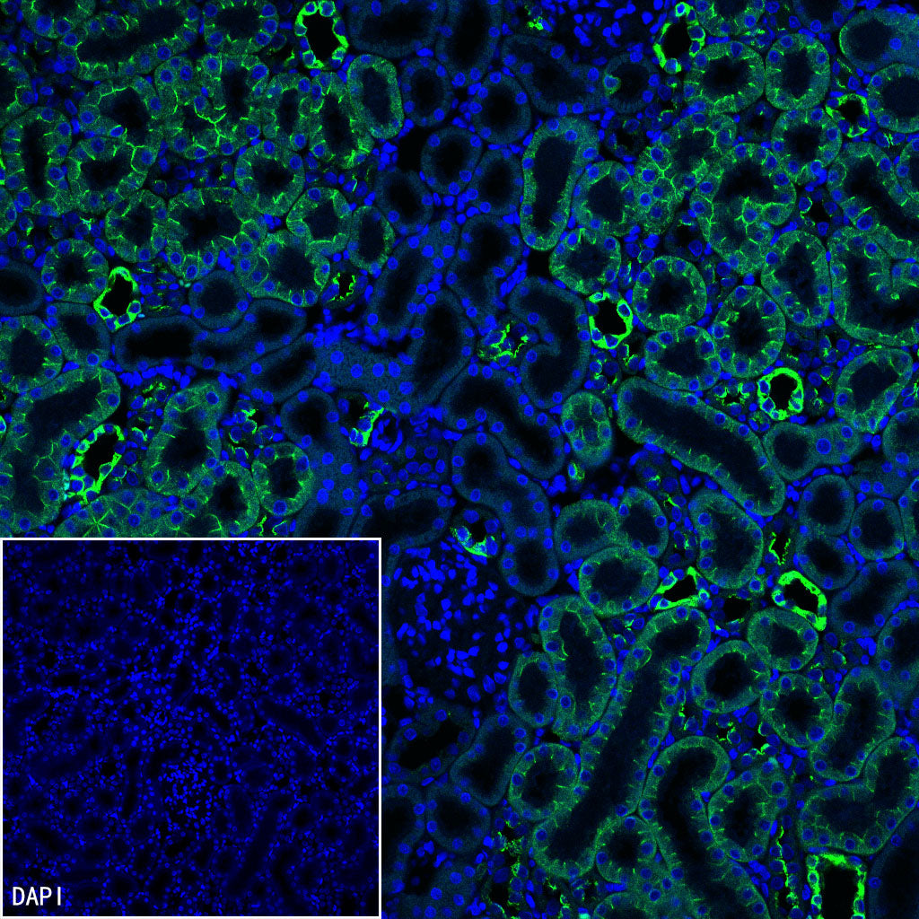 Cytokeratin 7 Recombinant Rabbit mAb (S-5954)