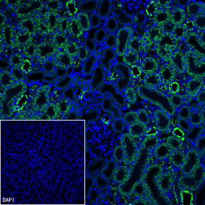 Cytokeratin 7 Recombinant Rabbit mAb (S-5954)