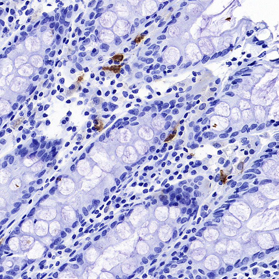 CLEC9A Recombinant Rabbit mAb (S-1904-154)