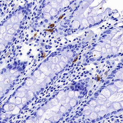 CLEC9A Recombinant Rabbit mAb (S-1904-154)