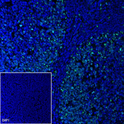 Ki67 Recombinant Rabbit mAb (Alexa Fluor® 488 Conjugate) (SDT-R459)