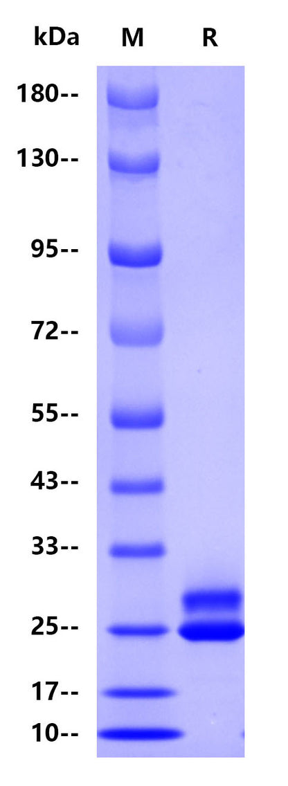 Human PRL Protein, His Tag