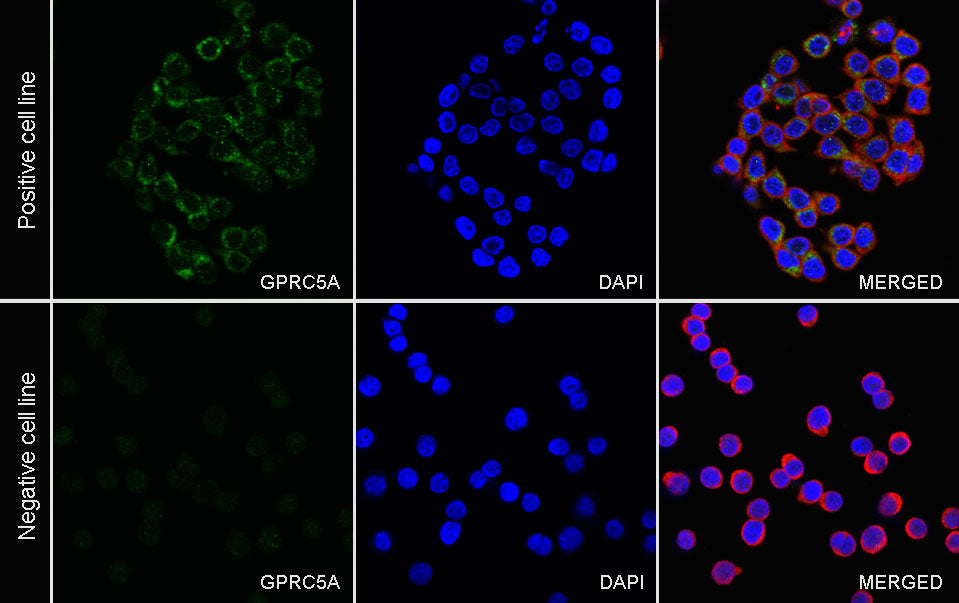 GPRC5A Recombinant Rabbit mAb (S-4383-15)
