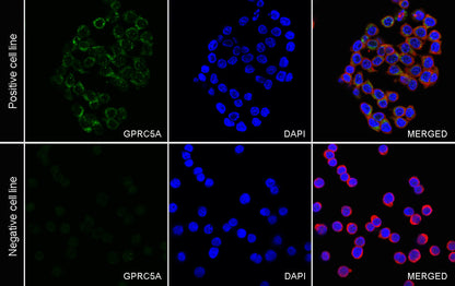 GPRC5A Recombinant Rabbit mAb (S-4383-15)