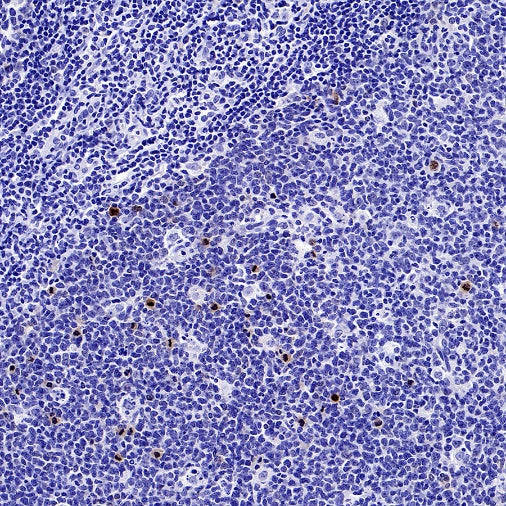 JNK1 + JNK2 + JNK3 (phospho T183+T183+T221) Recombinant Rabbit mAb (S-3593)