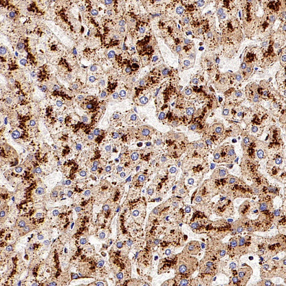 beta Galactosidase/GLB1 Recombinant Rabbit mAb (S-2295-7)