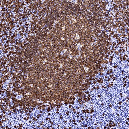 S-RMab® CD20 Recombinant Rabbit mAb,PBS Only (SDT-R133)