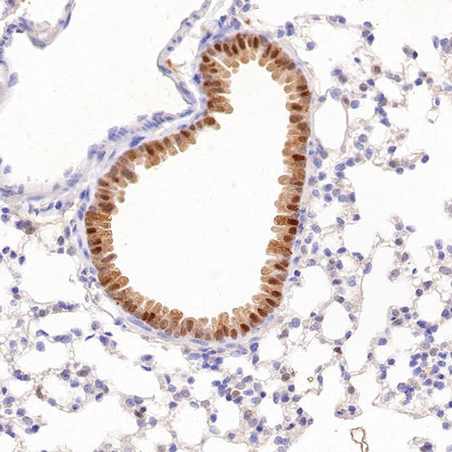 Superoxide Dismutase 1 Recombinant Rabbit mAb (S-1537-39)