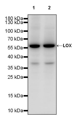 LOX Recombinant Rabbit mAb (S-1647-49)