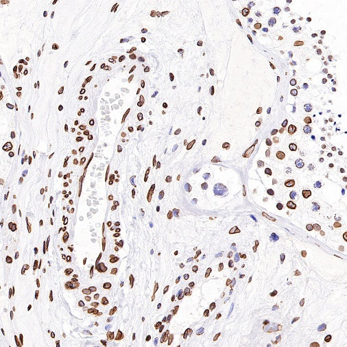 S-RMab®Lamin B2 Recombinant Rabbit mAb (S-951-70)
