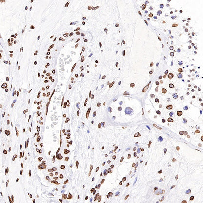 S-RMab®Lamin B2 Recombinant Rabbit mAb (S-951-70)