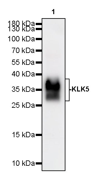 KLK5 Recombinant Rabbit mAb (S-4238-55)