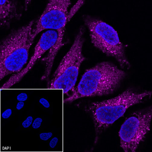Stat6 Recombinant Rabbit mAb (Alexa Fluor® 647 Conjugate) (SDT-337-32)