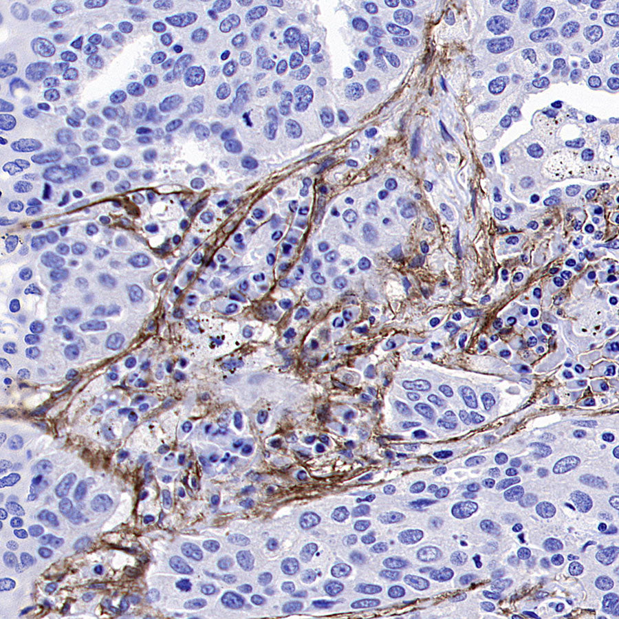 Fibroblast Activation Protein alpha/FAP Recombinant Rabbit mAb (S-3998-2)