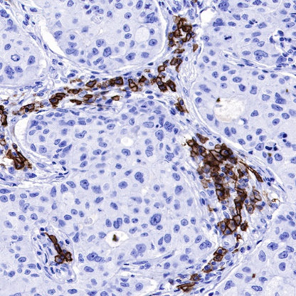 CD38 Mouse mAb (S-690-29)