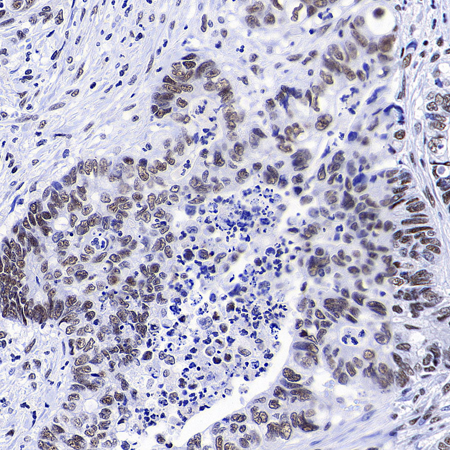 RBM10 Recombinant Rabbit mAb (S-4370-47)