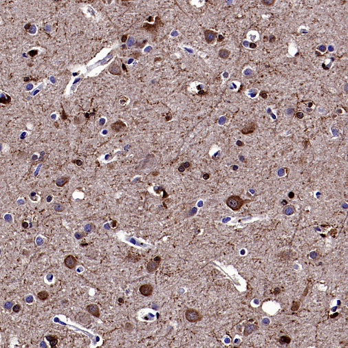Gelsolin Recombinant Rabbit mAb (S-2522-21)